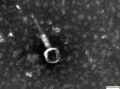 Elektronenmikroskopische Aufnahmen Bakteriophage
